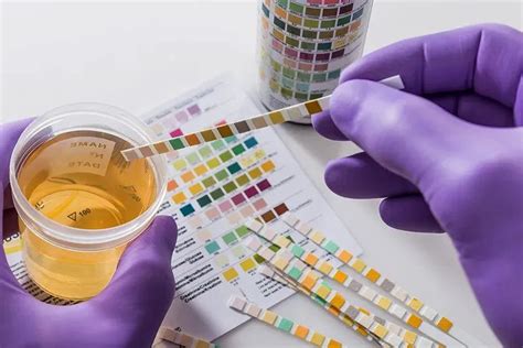 does duromine show up in a drug test|Urine drug tests: Uses, procedure, detection times, and .